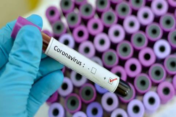 Pejuçara chega a 13 casos confirmados de Coronavírus